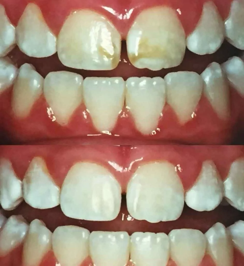 Smile Gallery Carroll Dental Care